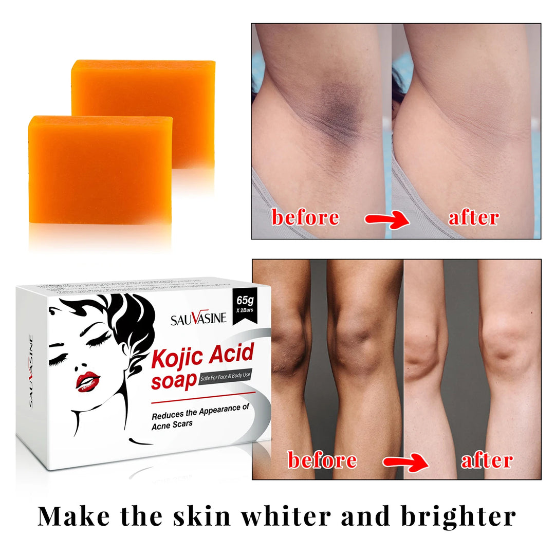 Kojic Acid Glow Soap Facial Deep Cleaning Even Skin Tone Skin Lightening Soap Oil Control Moisturizing Skin Care 65G X2